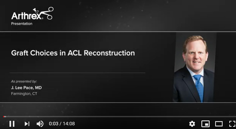 Graft Choices in ACL Reconstruction